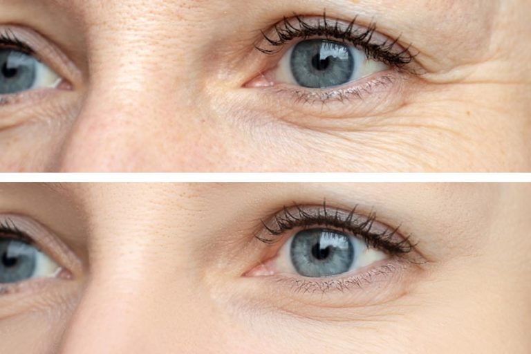 Brampton Cosmetic Clinic, Cosmetic Clinic In Brampton